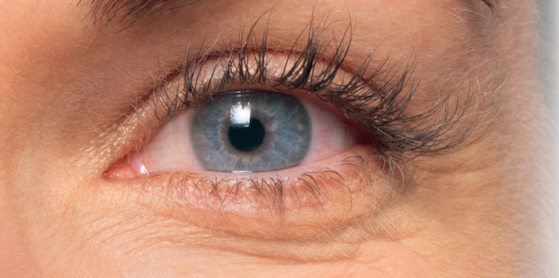 Eyelashes-Treatment-Results